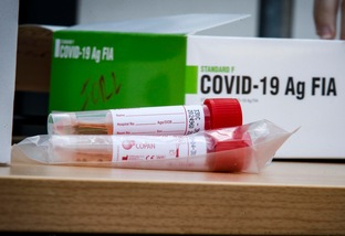 Coronavirus, 580 decessi in Italia in 24 ore. Oltre 35mila i nuovi casi