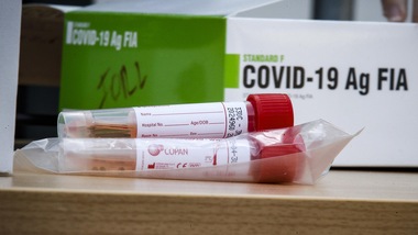 Coronavirus, 580 decessi in Italia in 24 ore. Oltre 35mila i nuovi casi