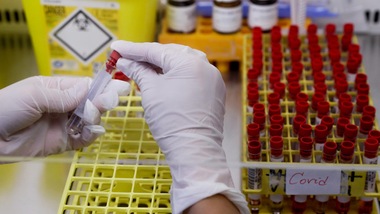 "Coronavirus, scoperto un antivirale che ne blocca la trasmissione"