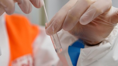 Coronavirus, i dati in Italia: 8.913 casi e 298 decessi nelle ultime 24 ore