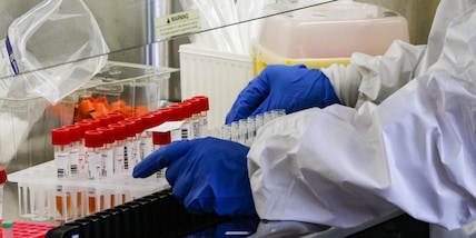 Coronavirus in Italia, i dati: cresce il tasso di positività