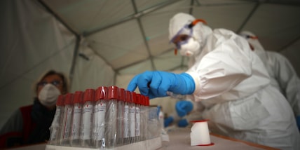 Il Covid provoca danni al cervello: "Riduce la materia grigia"