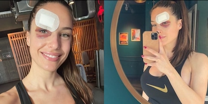 Agata Centasso, testata e occhio nero sui social: cosa è successo