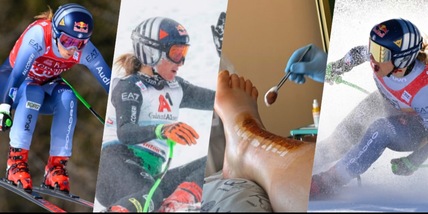 Goggia shock, mostra la cicatrice dopo l'infortunio: l'immagine sui social