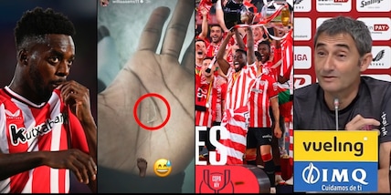 Incredibile Inaki Williams: ha giocato due anni con un vetro nel piede