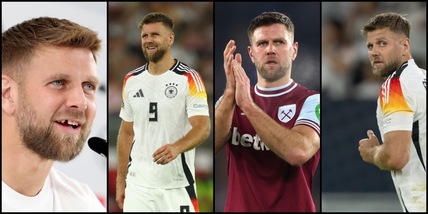 Lo ricordate? Buco tra i denti e gol pesanti all'Europeo, proposto alla Juve