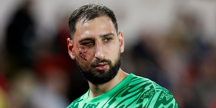 Donnarumma shock, che botta! Via dal campo con il volto sfregiato