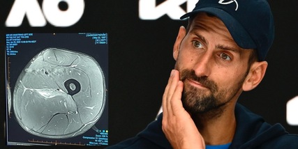 Djokovic polemico, zittisce tutti con un post: "Per gli esperti di infortuni"