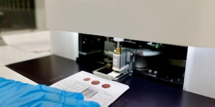 Giornata Mondiale della Fibrosi Cistica: con Genoma Puglia la diagnosi precoce diventa realtà, scoperti oltre 5 casi nei neonati