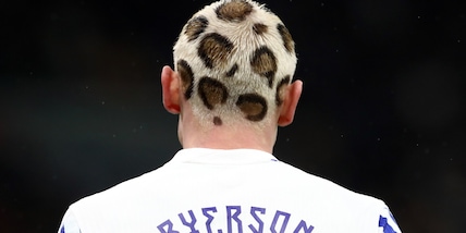 Contro l'Italia con i capelli maculati: il look di Ryerson è virale sul web