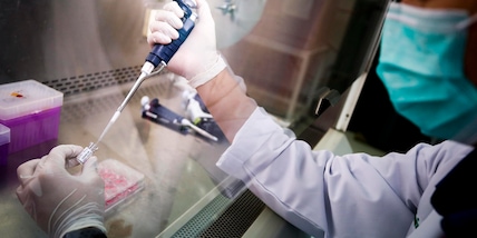 Nel mondo 230 trial su vaccini mRna per 20 tumori ma Sos fondi