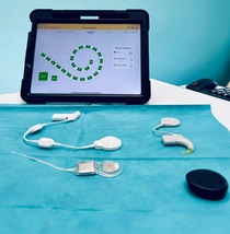 Al Policlinico di Bari impianto cocleare smart, bimbo di 11 recupera udito