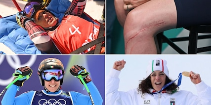 Brignone, il chirurgo esterrefatto: "Oro fuori dalla realtà. Ecco qual è stata la svolta definitiva"