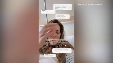 Operazione al naso per Ludovica Pagani, il racconto dell'influencer