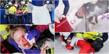 Sellier, tragedia sfiorata alle Olimpiadi: lama sull’occhio e volto ricoperto di sangue