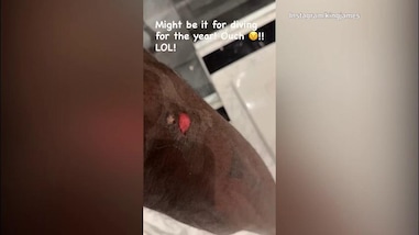 Basket, Lebron James fa vedere la sua ferita