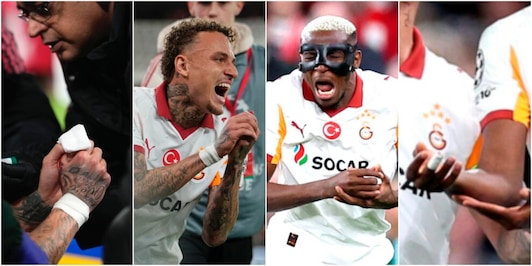 Lang e il rischio amputazione del dito, frattura per Osimhen: Galatasaray ko a Liverpool... in tutti i sensi!