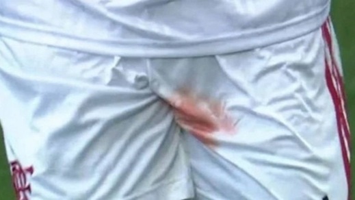 Gustavo Henrique shock: il terribile infortunio ai testicoli