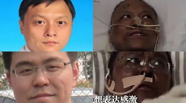 Dalla Cina: "Coronavirus, due medici si sono risvegliati con la pelle scura"
