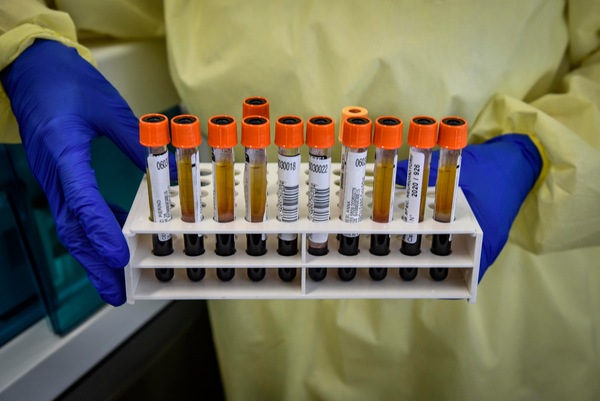Coronavirus, i dati in Italia: 4.917 guariti in un giorno
