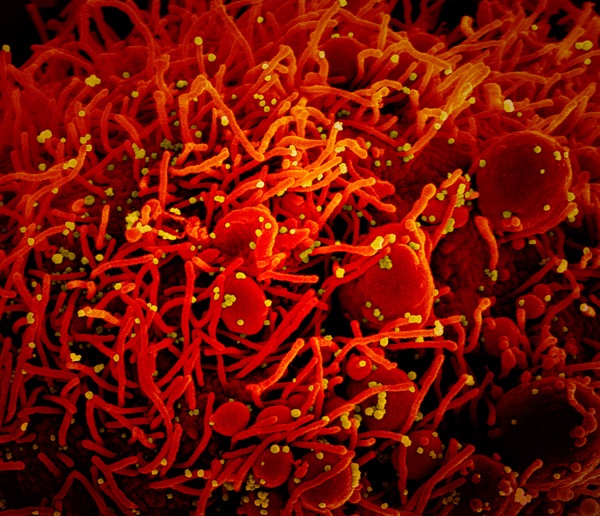 Coronavirus, in Italia circolava da prima dell'epidemia: ecco la conferma