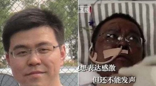 Coronavirus, muore in Cina il medico che si era risvegliato con la pelle nera