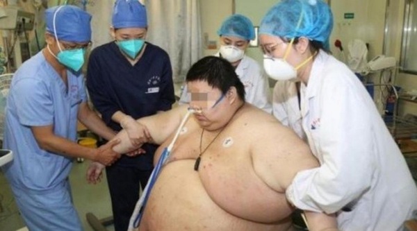 Coronavirus, 26enne ingrassa 100 kg durante la quarantena