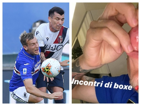 Sampdoria, La Gumina scherza sulla ferita alla bocca: "Incontri di boxe"