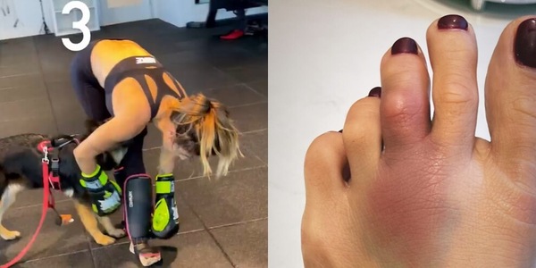 Elisabetta Canalis si è rotta un dito! Che dolore...