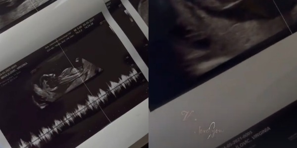 Virginia Mihajlovic mostra l'ecografia del bebè
