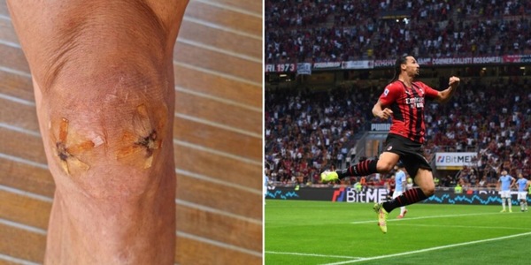 Ibrahimovic celebra il gol pubblicando la foto del ginocchio operato