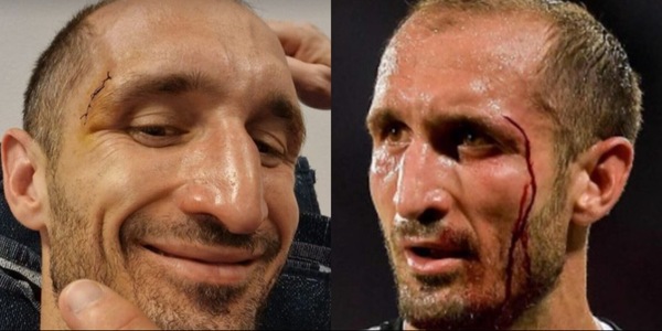 Juve, Chiellini guerriero 'fino alla fine': "Ognuno ha il suo destino"