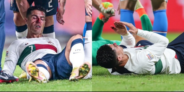 Paura Cristiano Ronaldo: scontro durissimo e sangue dal naso