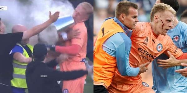 Follia in Australia! Portiere colpito da una secchiata: volto insanguinato