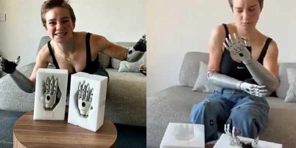 Bebe Vio e le nuove mani bioniche: "Potrò fare tutti i gesti"
