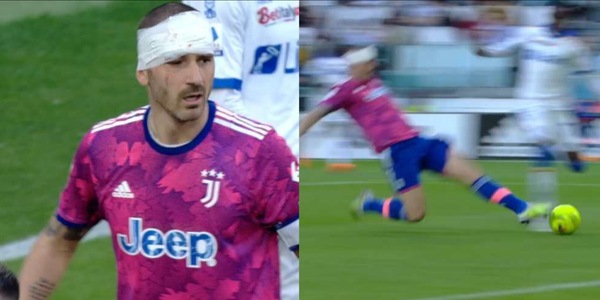 Bonucci si traveste da Chiellini: turbante e tackle decisivo in Juve-Lecce