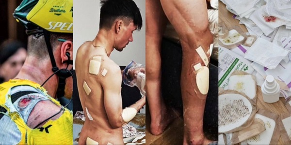 Roglic shock, il post denuncia: "Caduta nel ciclismo, ecco che succede"