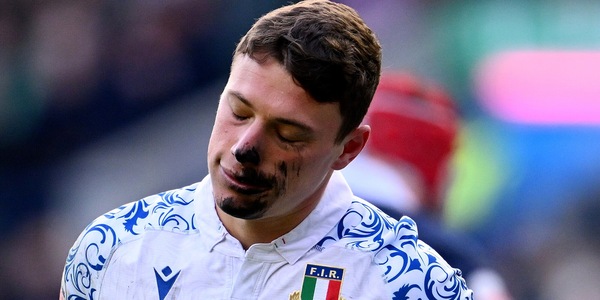 Sei Nazioni, l'Italia cede nel finale: a Edimburgo vince la Scozia