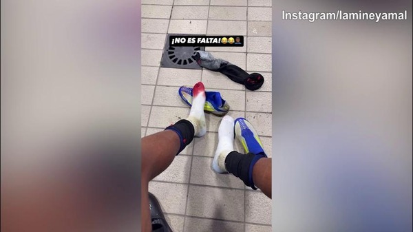 Barca, Yamal mostra il piede insanguinato e ironizza: "Non era fallo..."