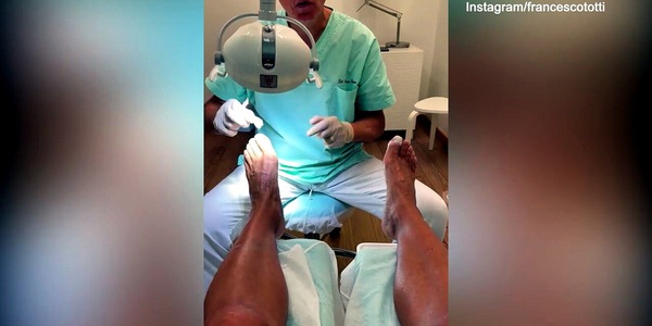 Totti, la pedicure è virale