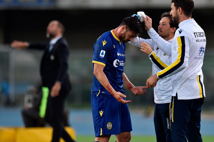 Verona, per Di Carmine leggero trauma cranico