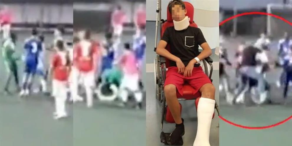 Squalifica di un anno per il portiere 13enne picchiato dal padre dell'avversario: la motivazione
