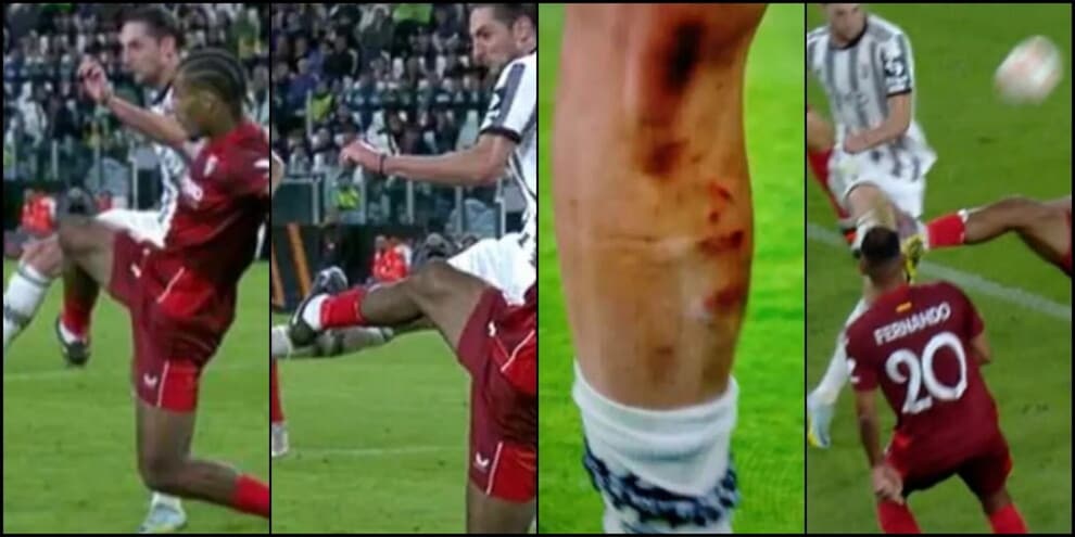 Gamba insanguinata e niente rigore alla Juve: ricordate? Ecco l'arbitro "molto bene" per lo Sporting

